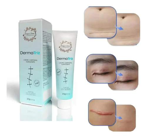 Pomada Creme Tratamento De Cicatrizes Dermatriz 20g.