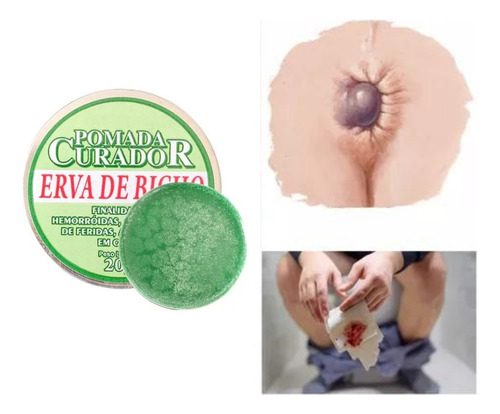 Pomada Para Hemorroida 100% Natural 20g - Cicatrizante 