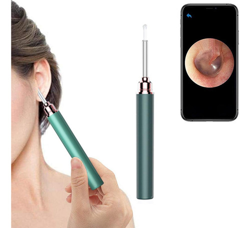 Cámara Removedora De Cerumen Inalámbrica Ear Cleaner Para Ni