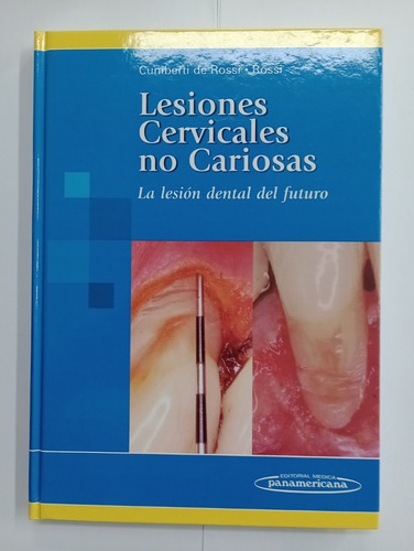 Lesiones Cervicales No Carilosas - Cuniberti De Rossi