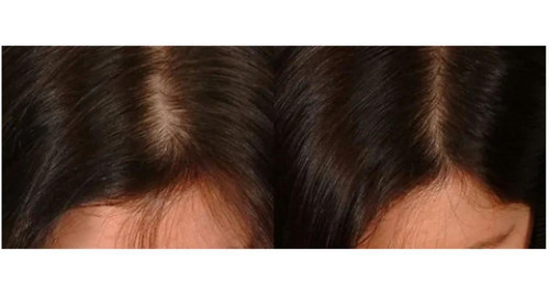 Tratamiento Reparador De Cabello, Mxhgo-003, 3xshampoo 250ml