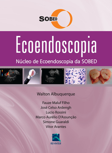 Ecoendoscopia, de Walton, Albuquerque. Editora Thieme Revinter Publicações Ltda, capa dura em português, 2015