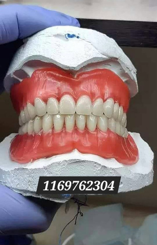 Prótesis Dental Acrílico Y Flexibles