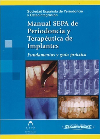 Manual Sepa De Periodoncia Y Terapéutica De Implantes - Pana