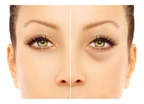 Corrector Profesional Elimina Ojeras Manchas Por Sol Sheló Tono Claro