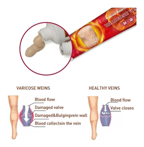 Sumifun - 2 Cremas Para Flebitis, Venas Varicosas, Varices