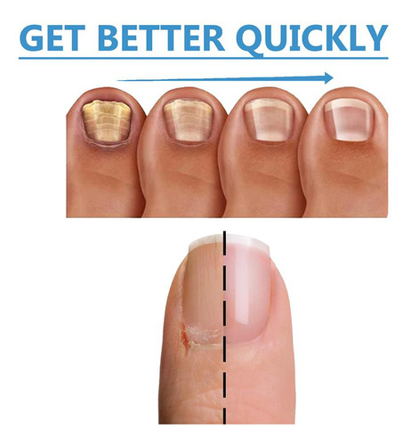 Adesivo Para Cuidados Com As Unhas 32 Peças