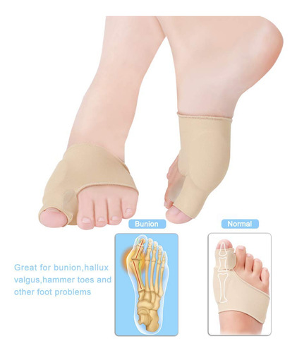 Corretor De Joanetes Com Almofada De Gel E Separador De Gel