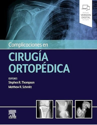 Complicaciones En Cirugía Ortopédica - Thompson 