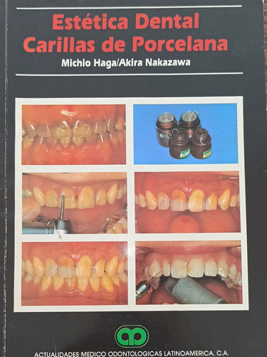 Libro Odontología Carillas 