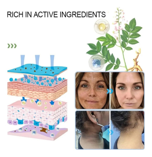 Gel Exfoliante Quarxery