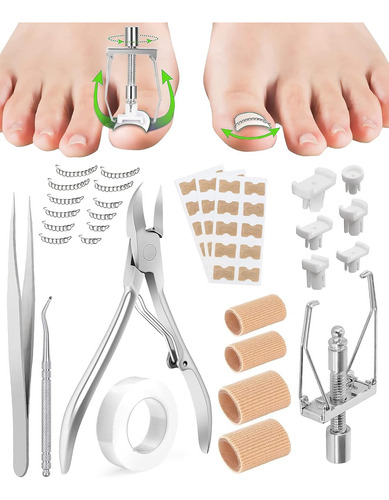 Kit De Eliminación De Uñas Encarnadas, Herramienta De Uñas E