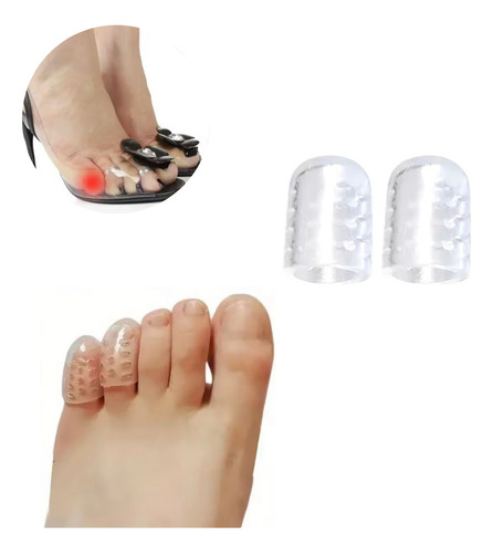 Kit Par Protetor Dedão Dedinho Pé Silicone Unha Encravada