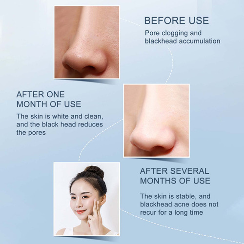 Limpiador Facial Importado Para Puntos Negros Y Poros