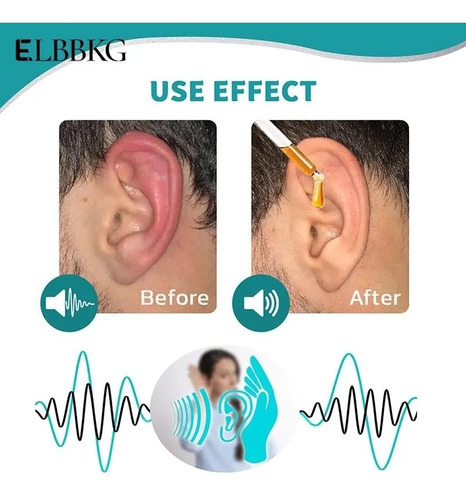 Aceite De Tinnitus Alivia Dolor Oídos, Sordera,zumbidos 10ml