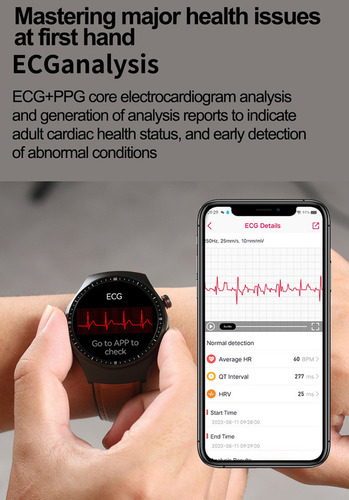 Reloj Inteligente Para Hombre Para Huawei Ios / Ecg /bg/bt