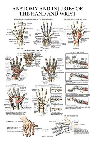 Póster Laminado De Anatomía Y Lesiones De Mano Y Muñ...