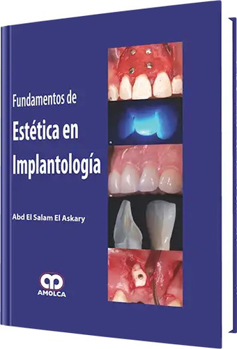 Fundamentos De Estética En Implantología Askary