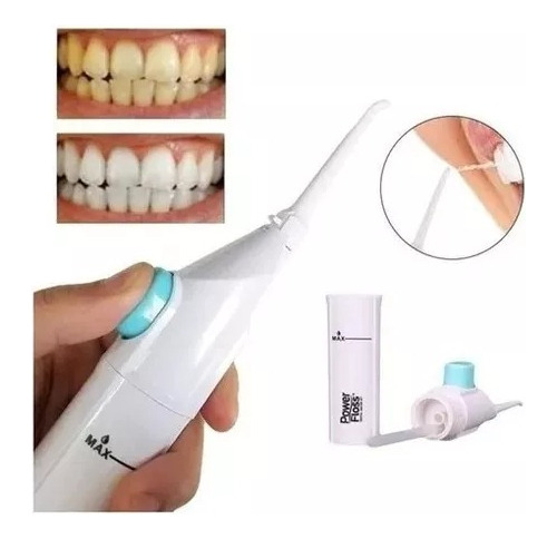 Irrigador Bucal Para Limpieza Dental Brakets Presión C/ Agua