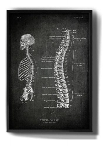 Quadro Decorativo Esqueleto Anatomia Coluna Desenho