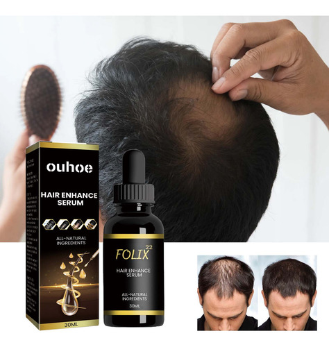 S Hair Growth Formula, Hair Growth Serum,hair Growth Oi 1011