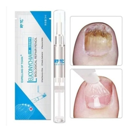 Caneta Com Solução Anti Micose E Anti Fungos Unhas Saudaveis