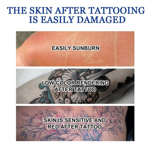 Crema Para Eliminar Tatuajes En Crema, 2 Unidades