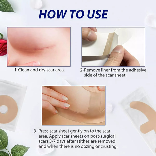 Parche Cicatriz Mama Mastopexia Mastoplastia 1 T 1 Areola Fragancia Neutra