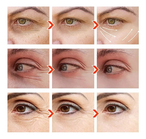 - Crema For Ojos Con Granada Roja De Sadoer (1 Unidad)