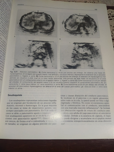 Ecografía Abdominal (Usado)