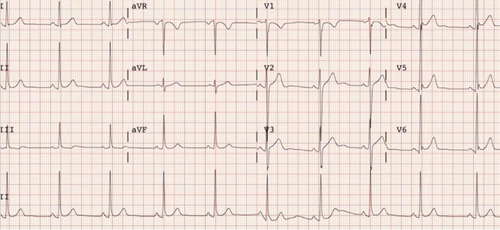Imagen 2 de 4 de Apto Físico, Electrocardiograma. Estudios Cardiológicos