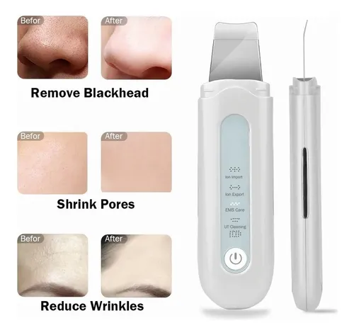 Kit De Cuidado Facial, Eliminación Del Acné, Fregador, Ems