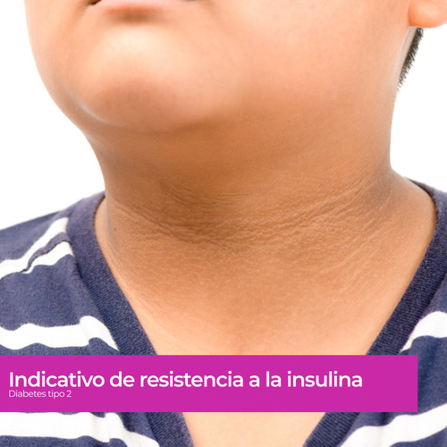 Tira Reactiva Para Glucosa Para Equipo 4 En 1 Reddyz
