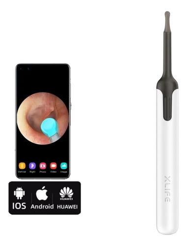 Otoscopio Digital-removedor De Cerumen Xlifex0 Bebird Blanco