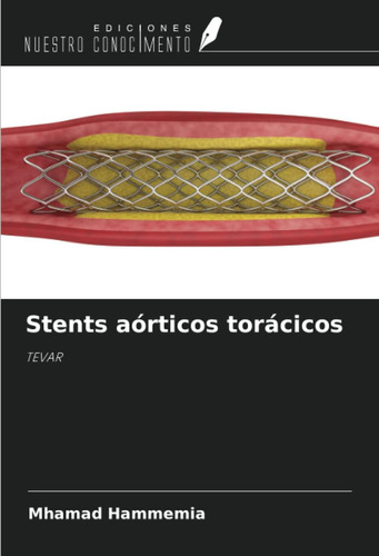 Libro: Stents Aórticos Torácicos: Tevar (spanish Edition)