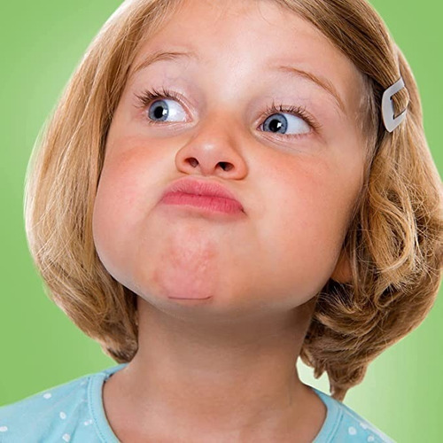 Mederma Tratamiento De Cicatrices Para Niños 20g