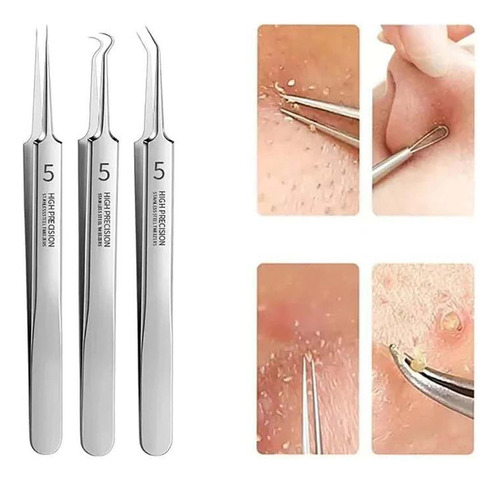 Pinzas Eliminadoras De Puntos Negros Ff Facial De Acero Inox