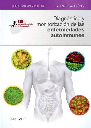 Diagnóstico Y Monitorización De Las Enfermedades Autoinmunes