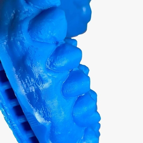 Imagem 4 de 5 de Resina Pro - Dental - Azul - Loja 3d - Dlp/lcd - 5kg