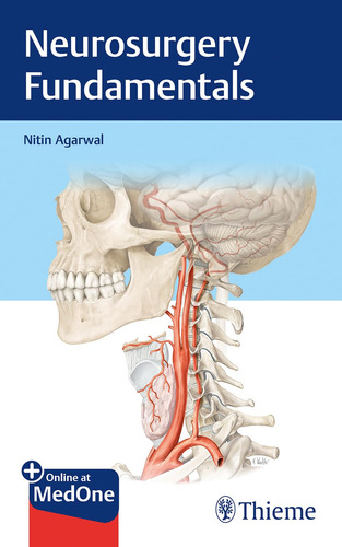 Fundamentos De Neurocirugía