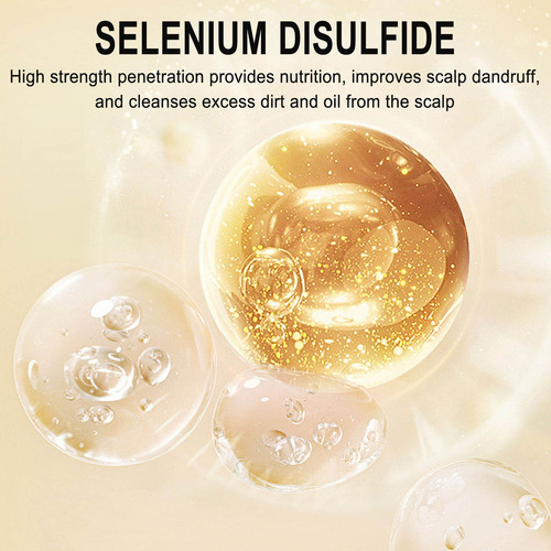Shampoo Control Scalp De 400 Ml Shampoos Refrescantes Scalp