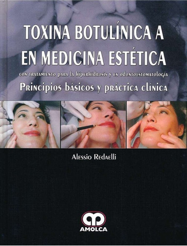 Toxina Botulinica A En Medicina Estetica, De Redaelli, A.. Editorial Amolca En Español