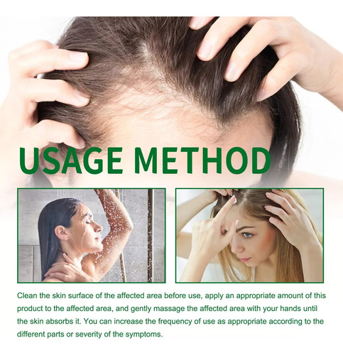 Pm Crema Para Dermatitis Seborreica, Psoriasis,