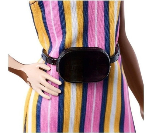 Imagem 3 de 7 de Barbie Fashionista 135 Negra Vitiligo Ms Sj