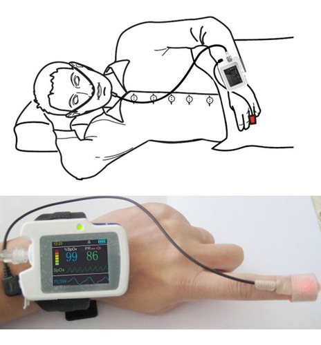 Poligrafo Contec Rs01 Apnea Del Sueño Monitor