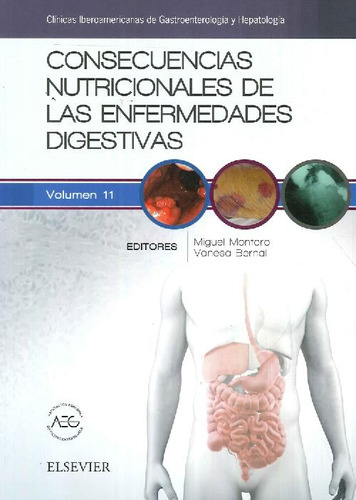 Libro Consecuencias Nutricionales De Las Enfermedades Digest