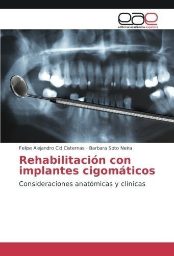 Rehabilitacion Con Implantes Cigomaticos: Consideraciones An