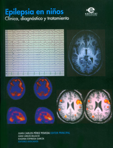 Epilepsia En Niños Clinica Diagnostico Y Tratamiento, De Pérez Poveda, Juan Carlos. Editorial Pontificia Universidad Javeriana, Tapa Blanda, Edición 1 En Español, 2014