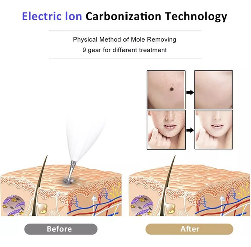 Cauterizador Plasma Elimina Verrugas Manchas Pecas
