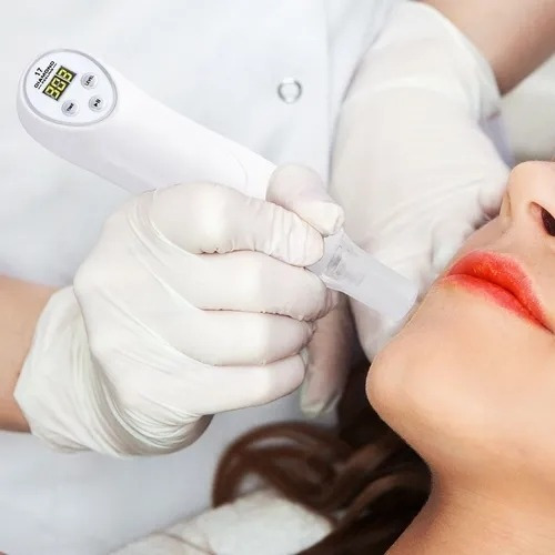 Acné Espinilla De Succión Microdermoabrasión Blackhead Instr